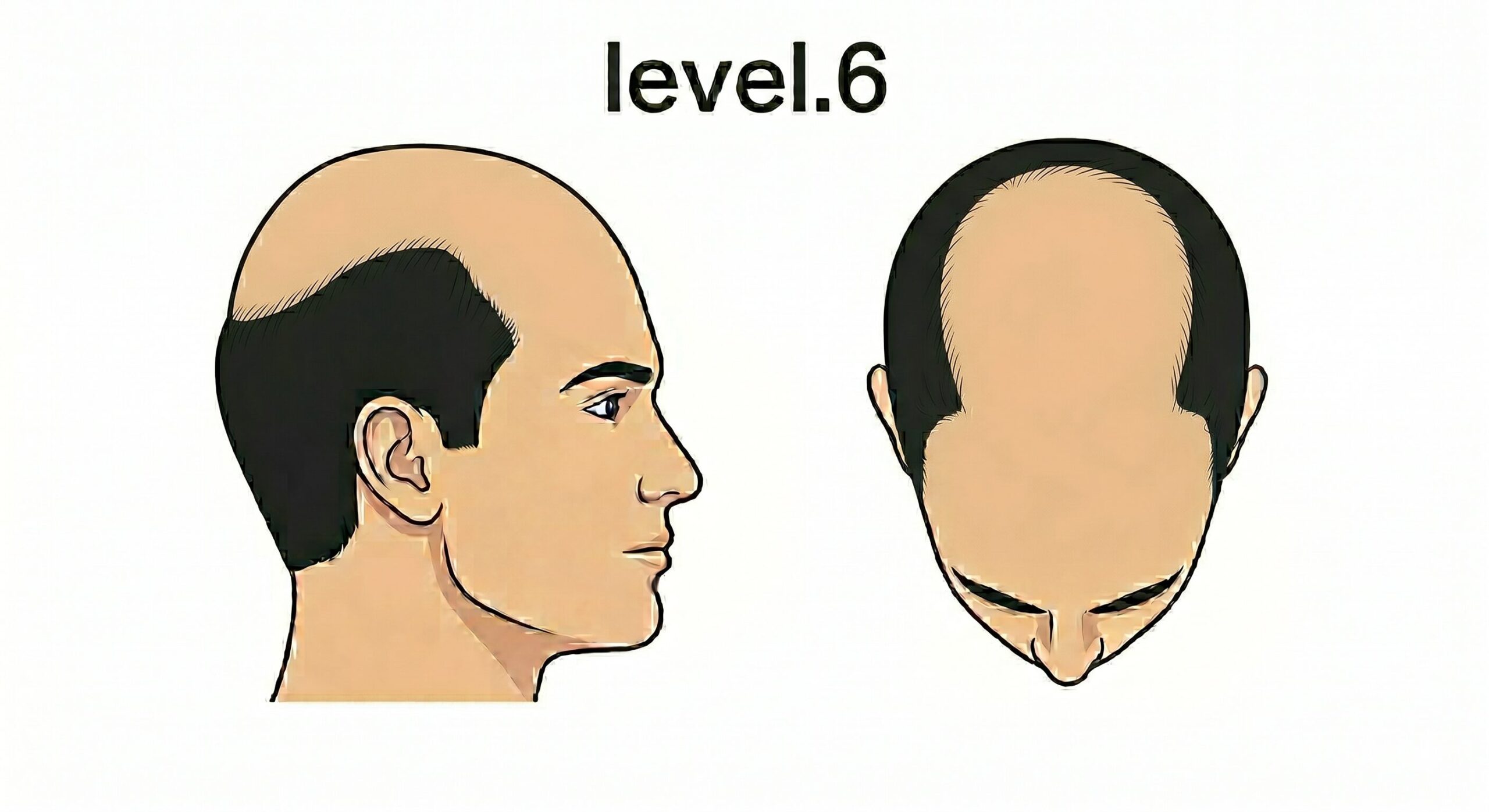 レベル6