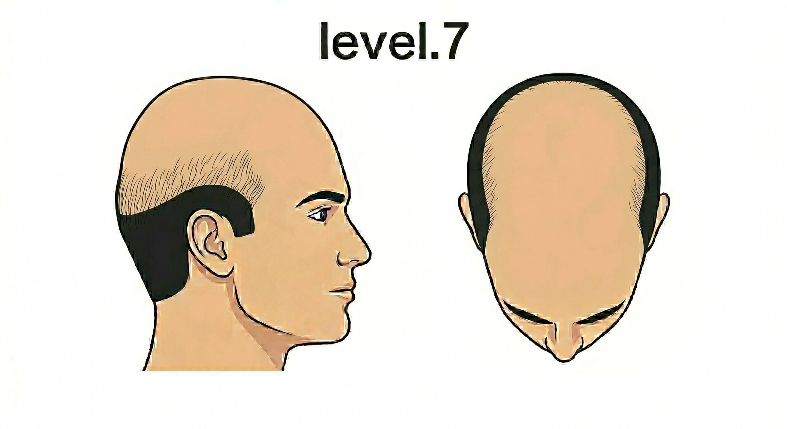 レベル7