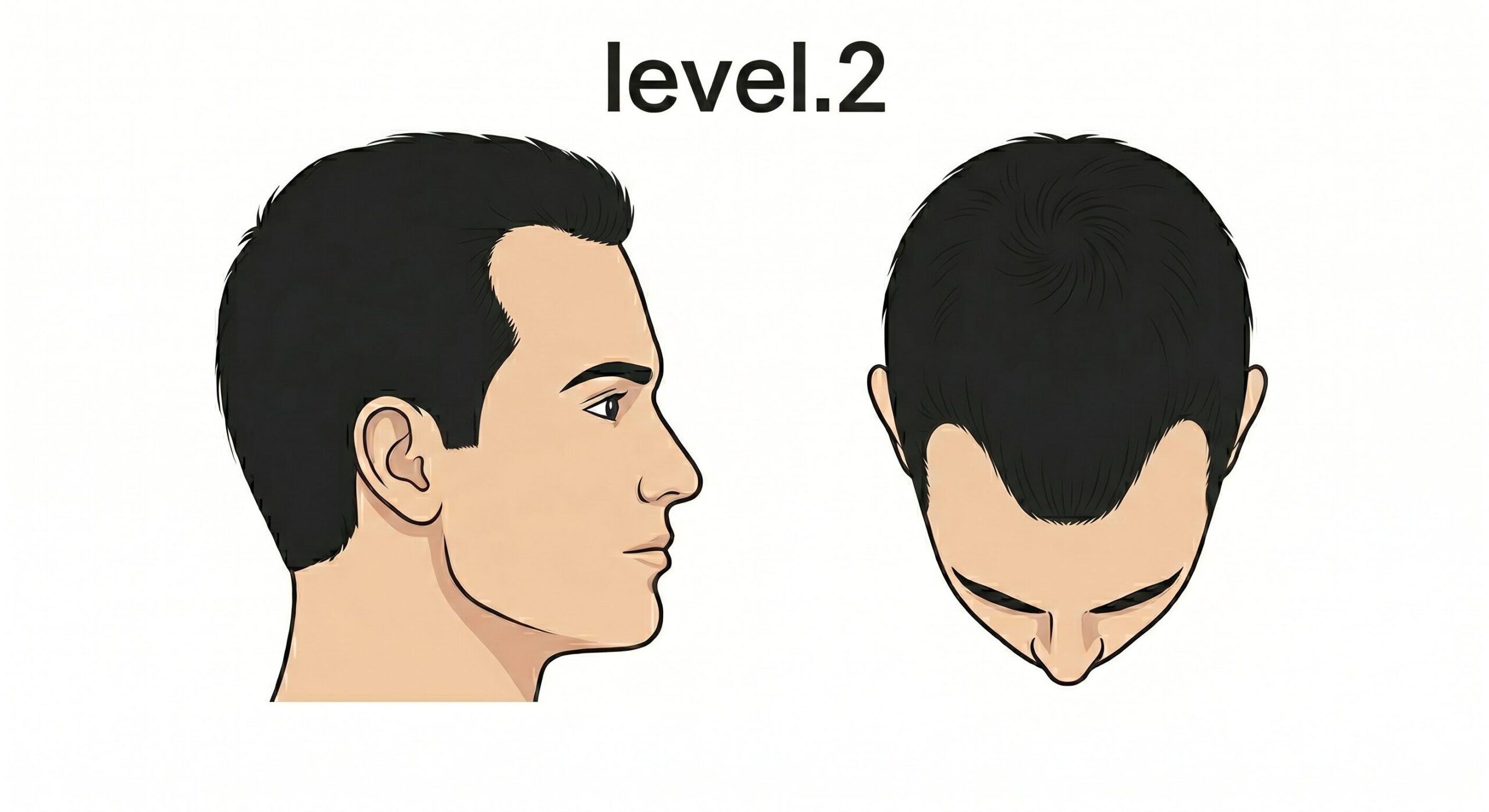レベル2