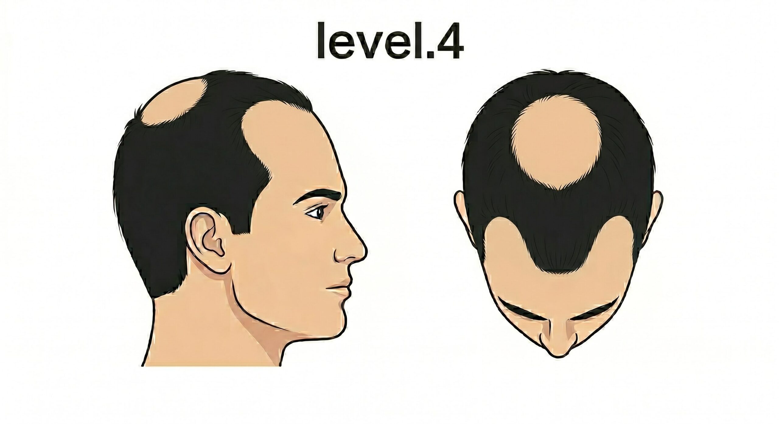 レベル4