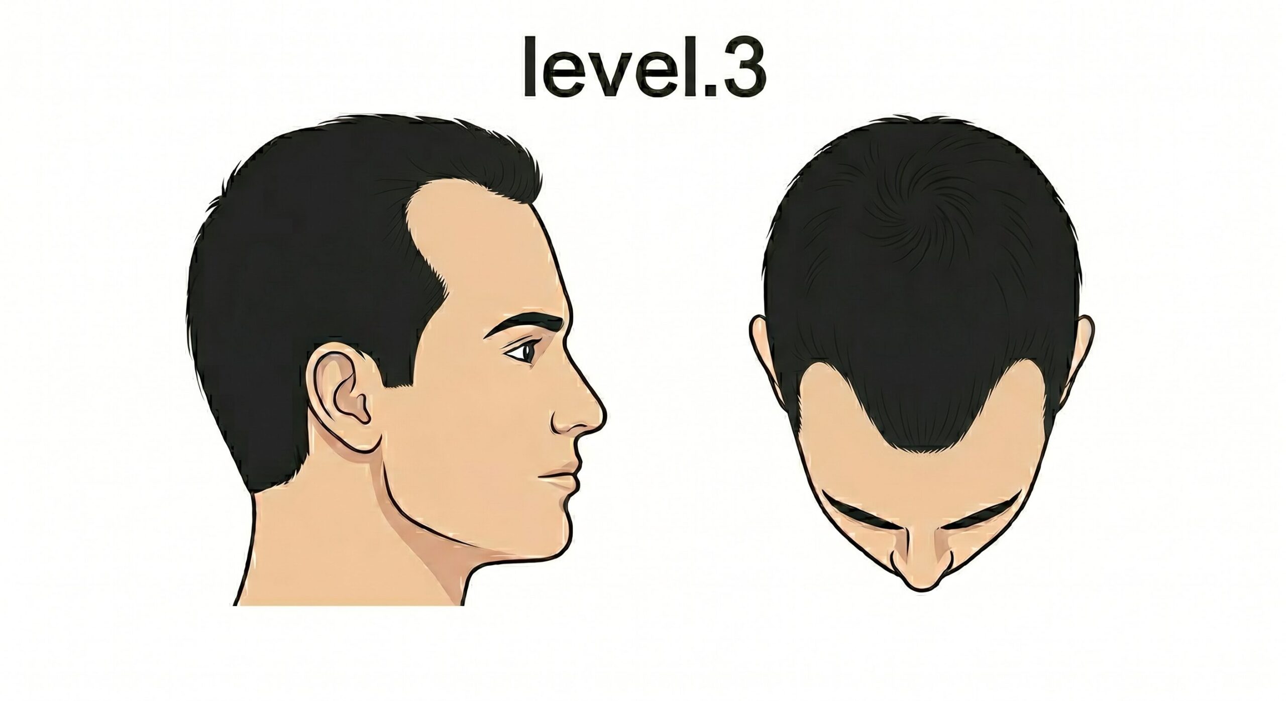 レベル3